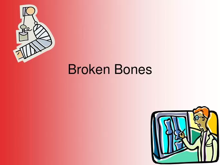 broken bones
