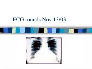 ECG rounds Nov 13/03