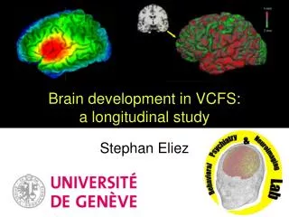 Brain development in VCFS: a longitudinal study