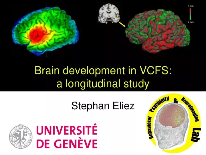 brain development in vcfs a longitudinal study