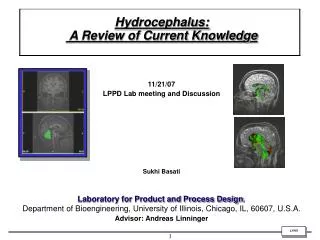 Hydrocephalus: A Review of Current Knowledge