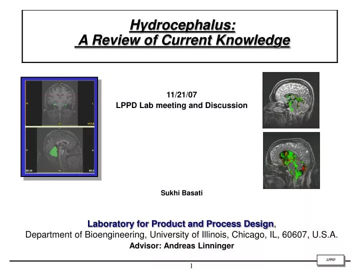 hydrocephalus a review of current knowledge