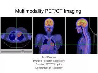 Multimodality PET/CT Imaging