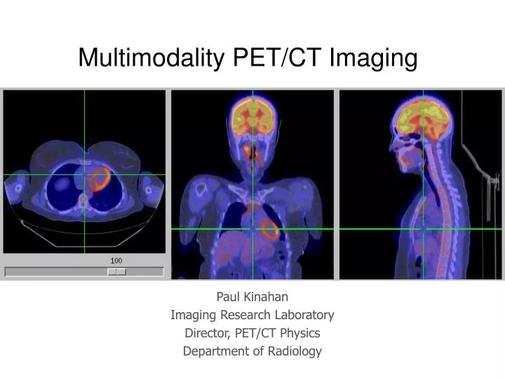 multimodality pet ct imaging