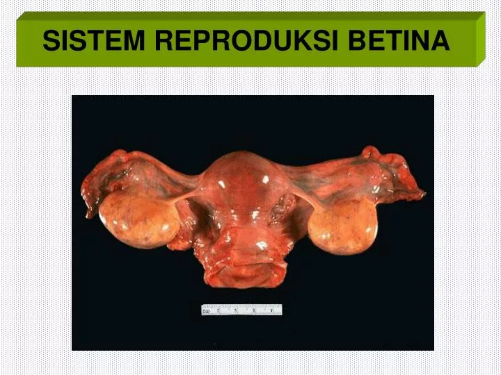 sistem reproduksi betina