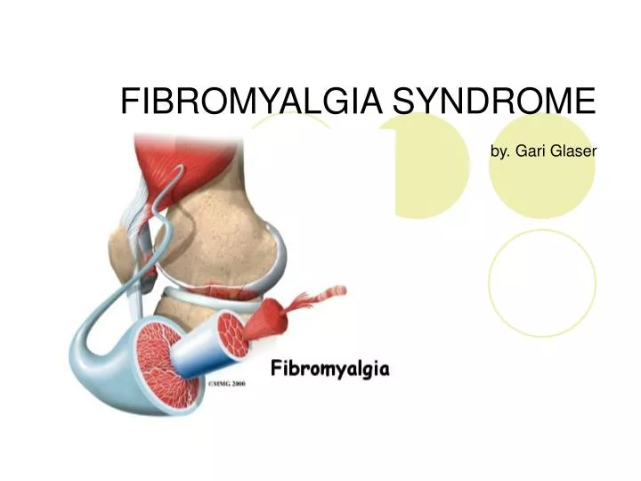 fibromyalgia syndrome by gari glaser