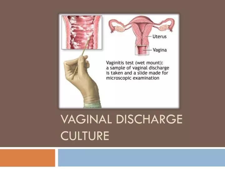 vaginal discharge culture