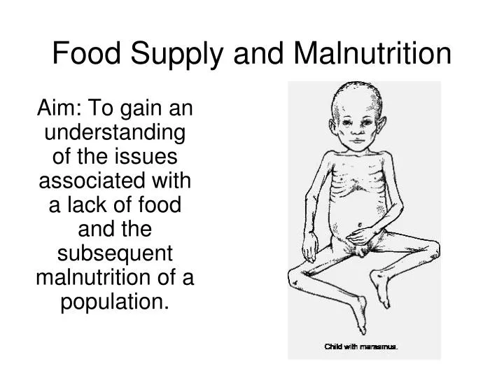 food supply and malnutrition