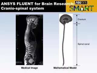 ANSYS FLUENT for Brain Research: Cranio-spinal system