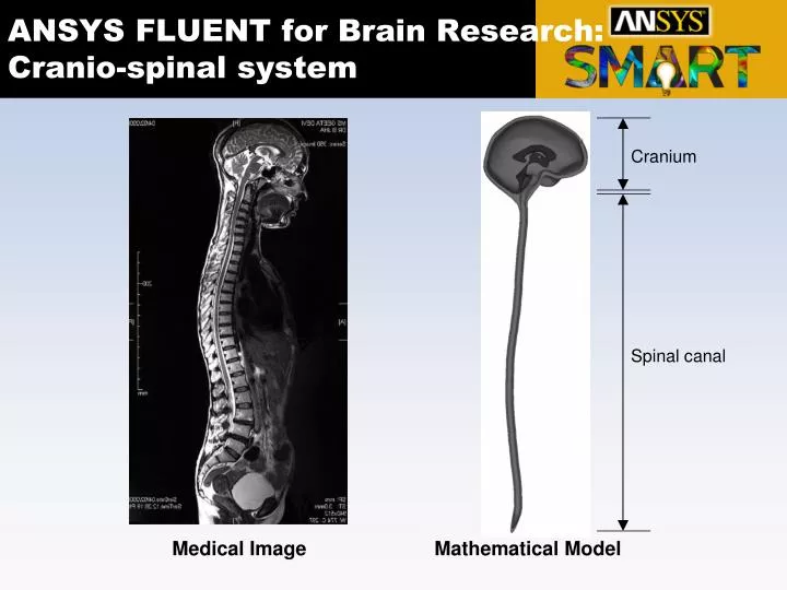 ansys fluent for brain research cranio spinal system