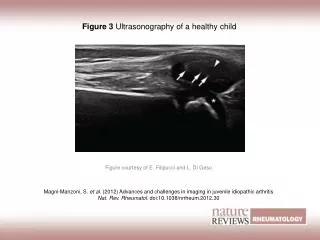 Figure 3 Ultrasonography of a healthy child
