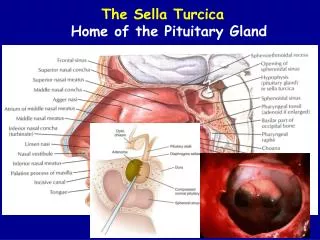 The Sella Turcica Home of the Pituitary Gland