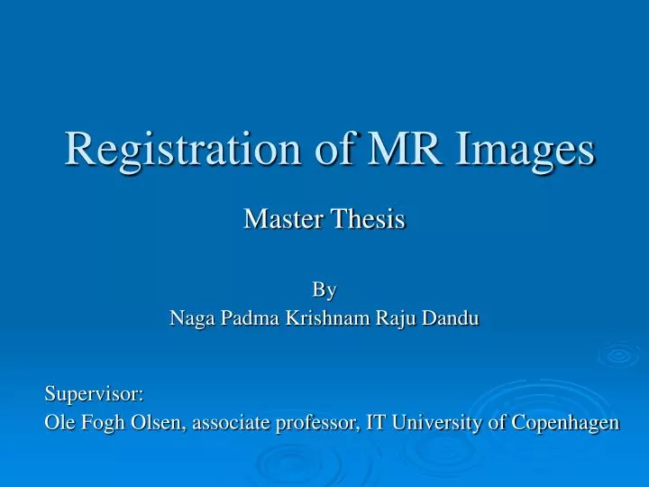 registration of mr images