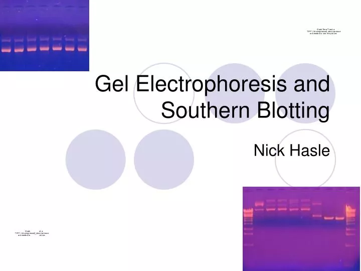 gel electrophoresis and southern blotting