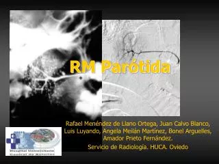 rm par tida