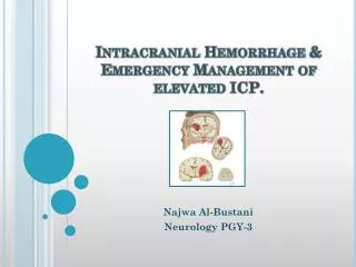 Intracranial Hemorrhage &amp; Emergency Management of elevated ICP.