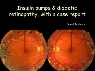 Insulin pumps &amp; diabetic retinopathy, with a case report