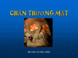 CHẤN THƯƠNG MẶT