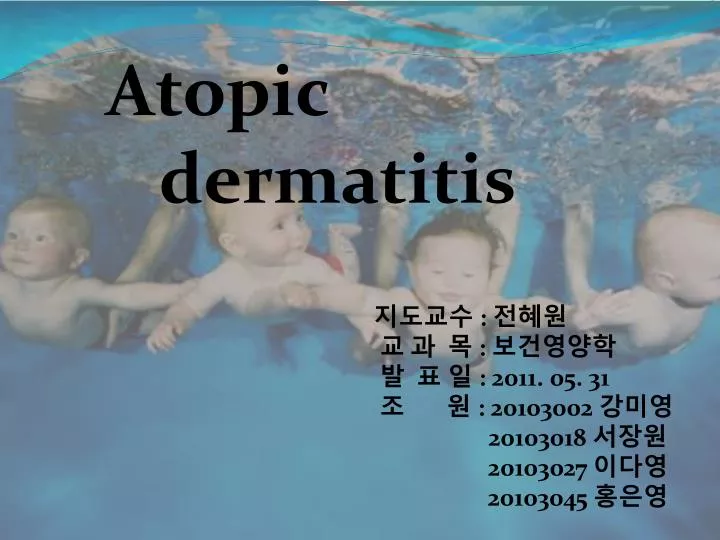 PPT - Atopic Dermatitis PowerPoint Presentation, Free Download - ID:4172311