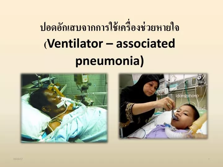 ventilator associated pneumonia