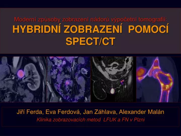 modern zp soby zobrazen n dor v po etn tomografi hybridn zobrazen pomoc spect ct