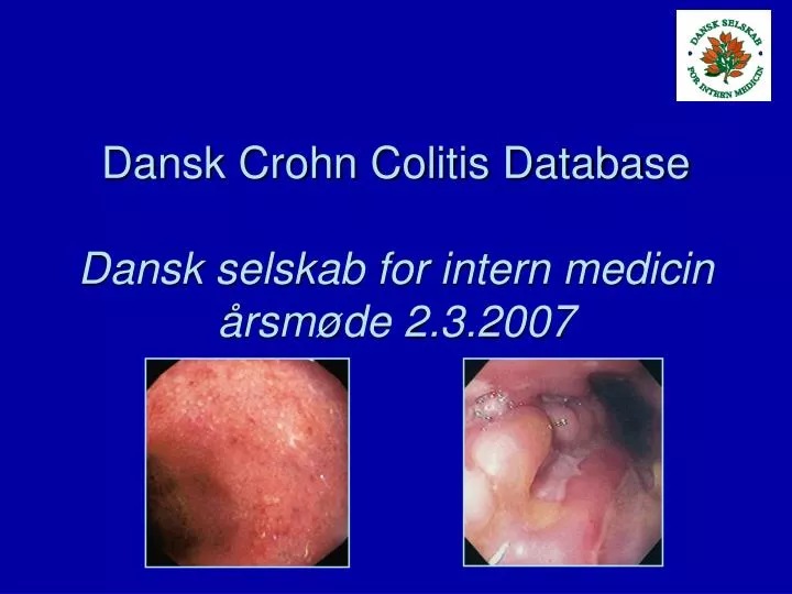 dansk crohn colitis database dansk selskab for intern medicin rsm de 2 3 2007