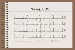 Normal ECG