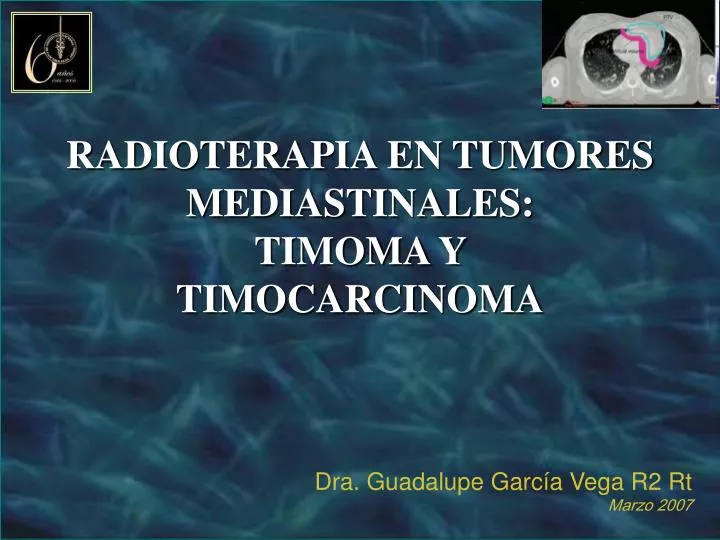 radioterapia en tumores mediastinales timoma y timocarcinoma