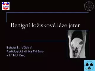 benign lo iskov l ze jater
