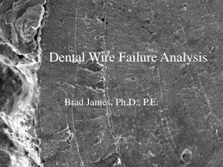 Dental Wire Failure Analysis