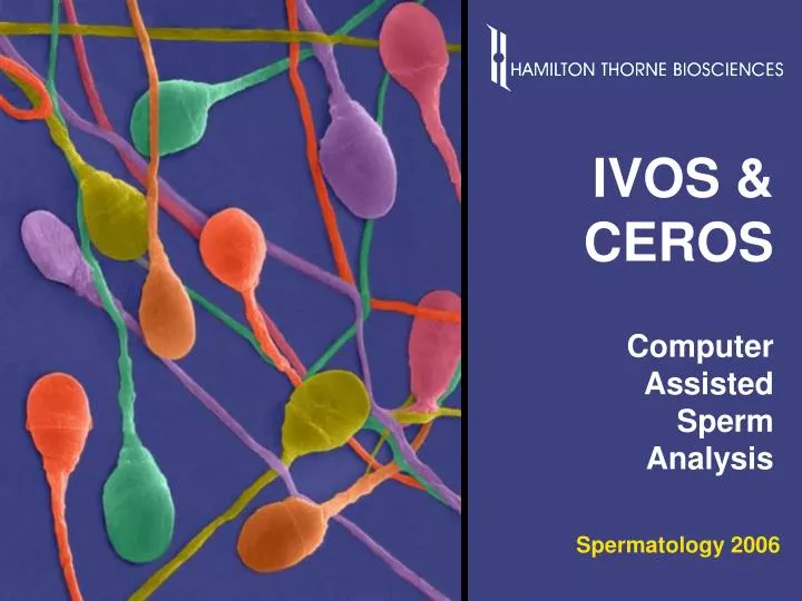 ivos ceros computer assisted sperm analysis