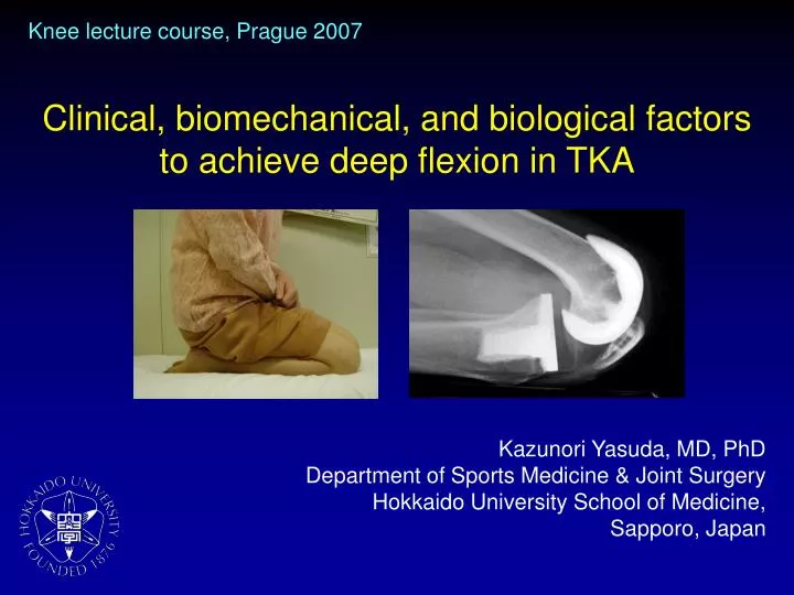 clinical biomechanical and biological factors to achieve deep flexion in tka