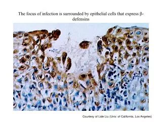 The focus of infection is surrounded by epithelial cells that express b -defensins