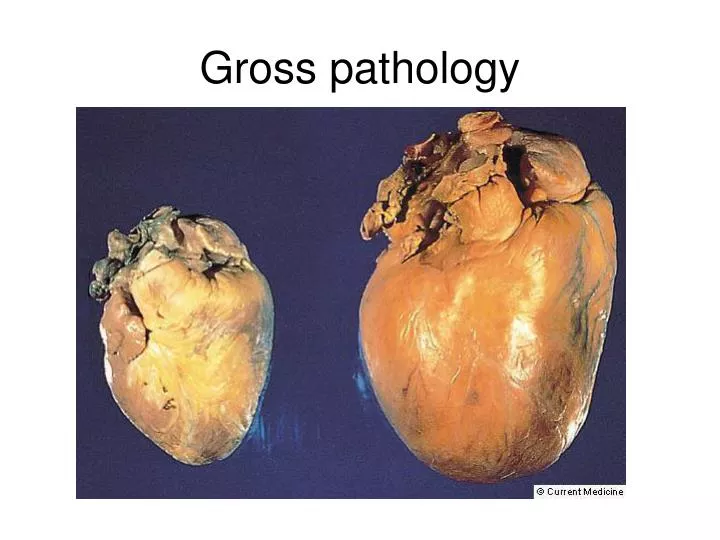 gross pathology