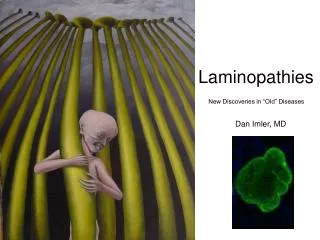 Laminopathies