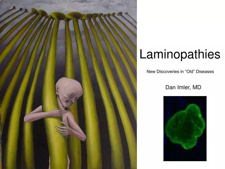 laminopathies