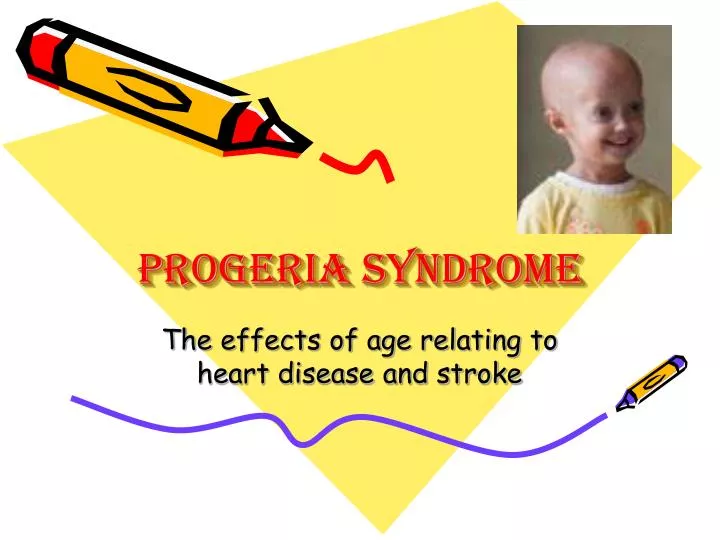 progeria syndrome