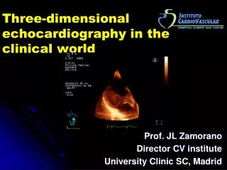 Three-dimensional echocardiography in the clinical world