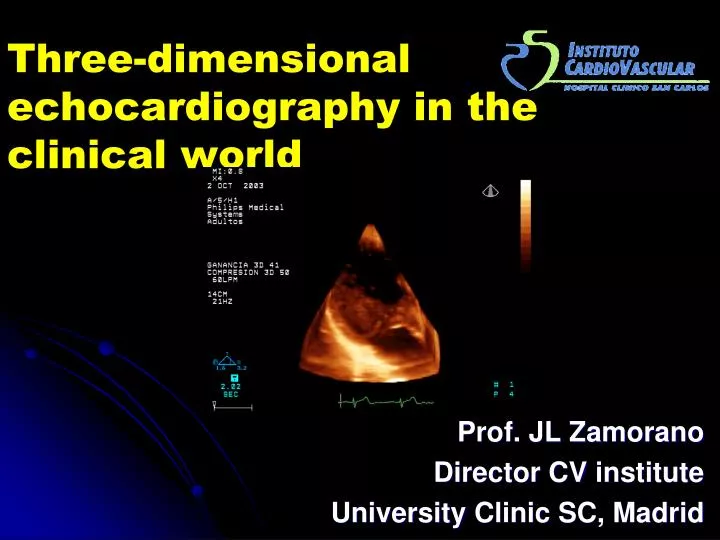three dimensional echocardiography in the clinical world