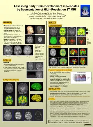 Assessing Early Brain Development in Neonates by Segmentation of High-Resolution 3T MRI