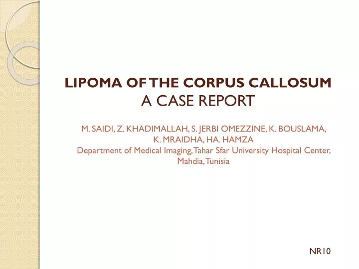 lipoma of the corpus callosum a case report
