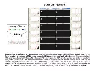 EGFR - Del 19 (Exon 19)