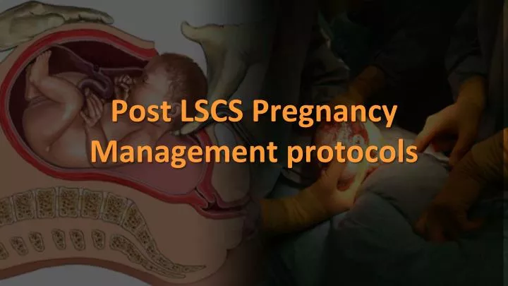 post lscs pregnancy management protocols