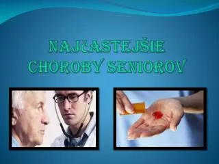naj astej ie choroby seniorov