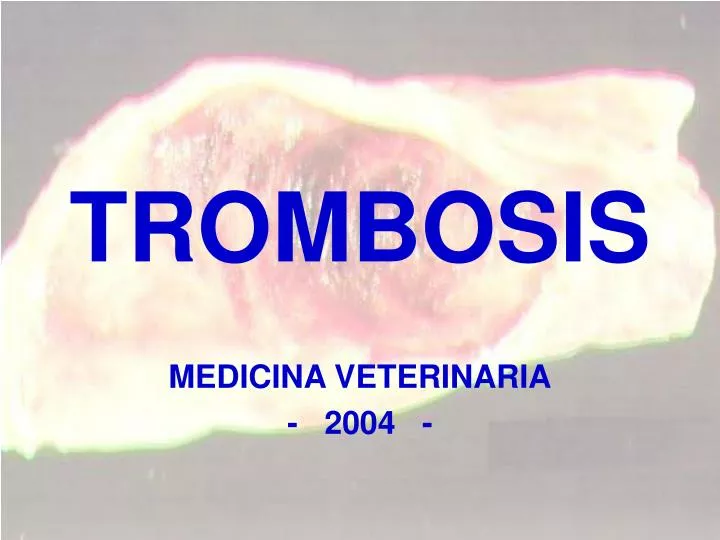 trombosis