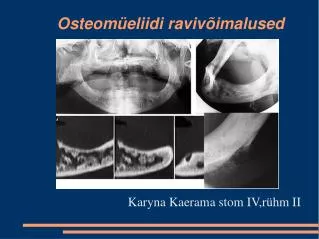 osteom eliidi raviv imalused