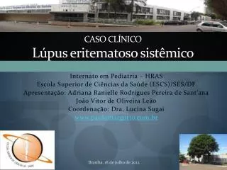 caso cl nico l pus eritematoso sist mico