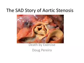 The SAD Story of Aortic Stenosis