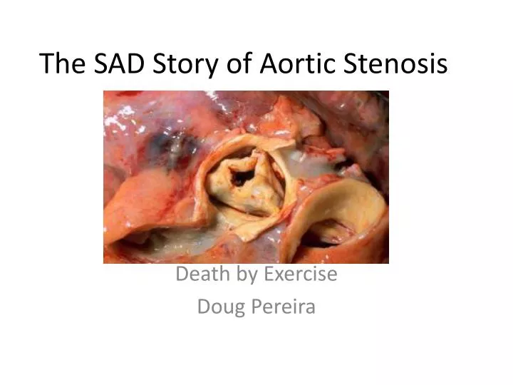the sad story of aortic stenosis