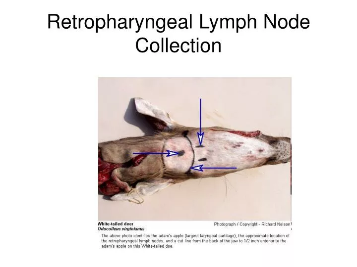retropharyngeal lymph node collection